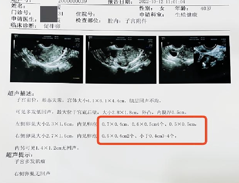 干细胞卵巢修复